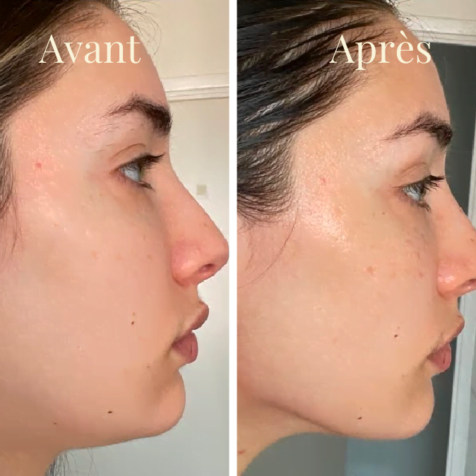 Kit Gua Sha en Jade
