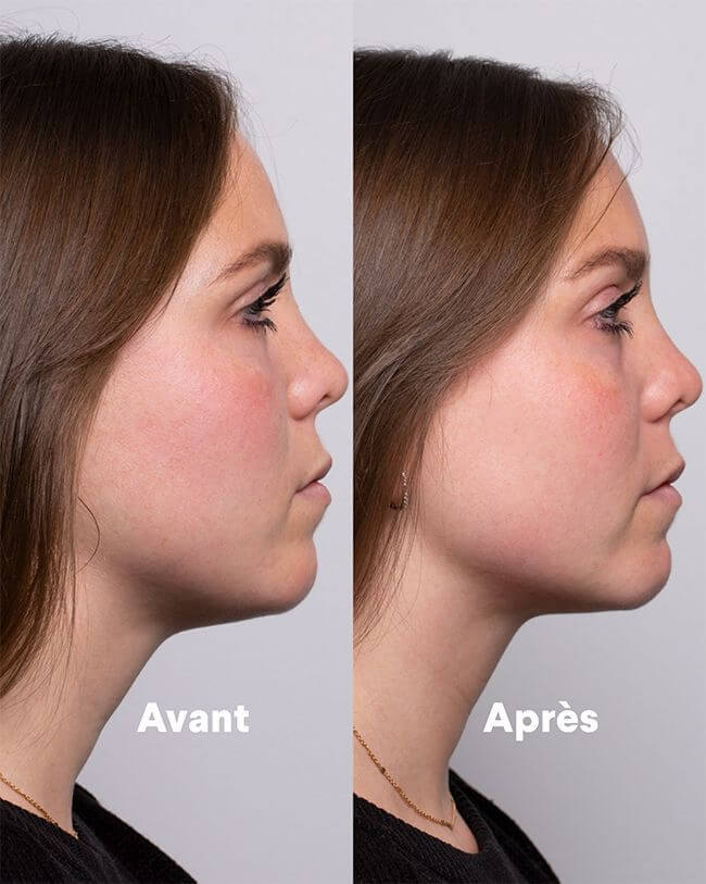 Kit Gua Sha en Jade